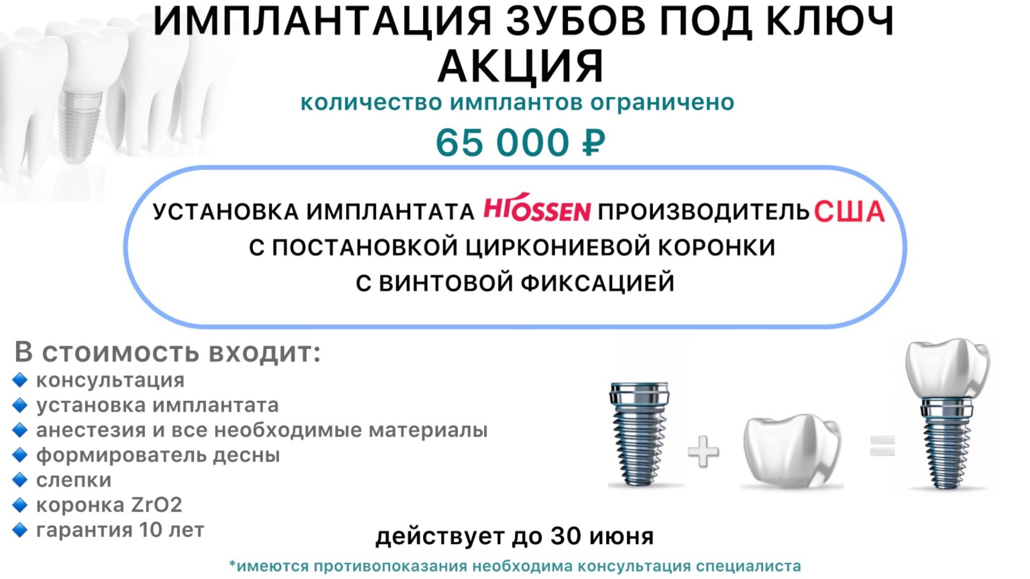 Небный расширитель в Путилково рядом со мной на карте: адреса, отзывы и  рейтинг медицинских центров - Zoon.ru