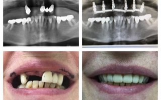 фотография работы врача Габриэля Михайловича Хамицева