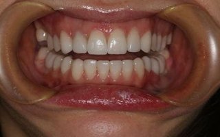 фотография работы врача Сергея Анатольевича Лабаня