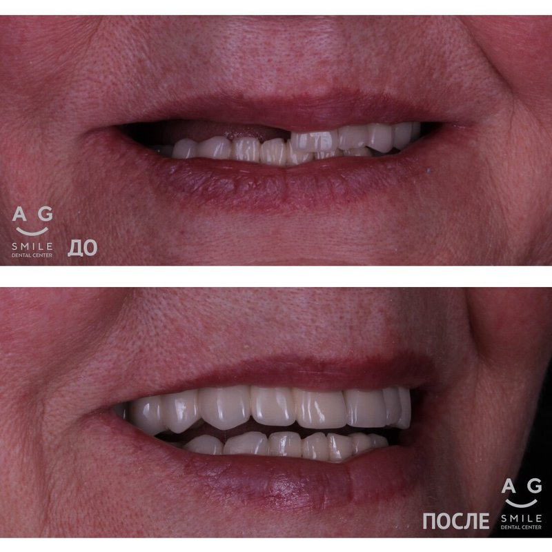 фотография работы Стоматологии AG-Smile на Новой Басманной улице