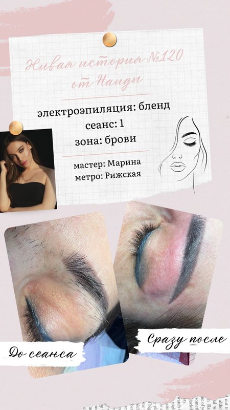 фотография работы Центра эпиляции Вселенная красоты на Трифоновской улице