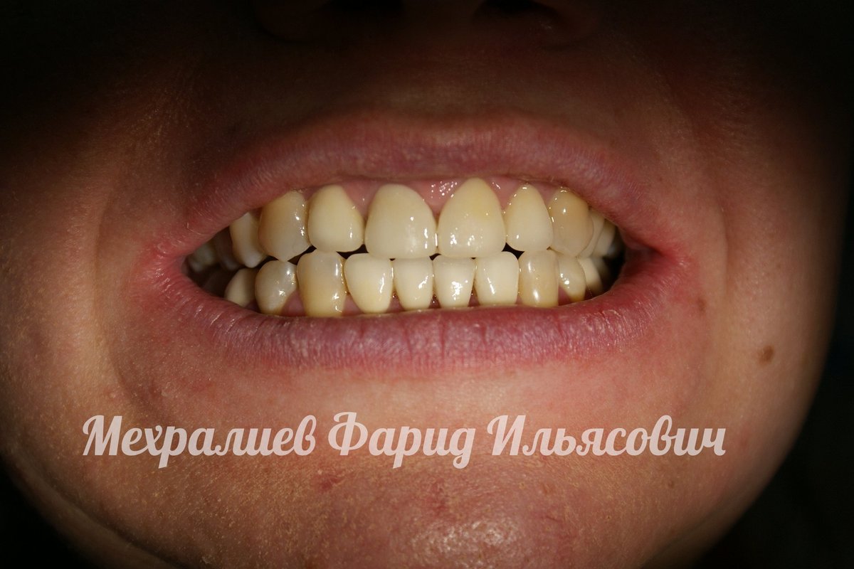 фотография работы Центра здоровья и красоты Медина в Балашихе