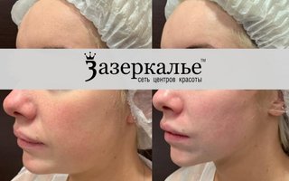 фотография работы врача Анжелики Викторовны Хешы