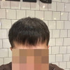 фото от пользователя Артем  в отзыве о клинике пересадки волос GGmed