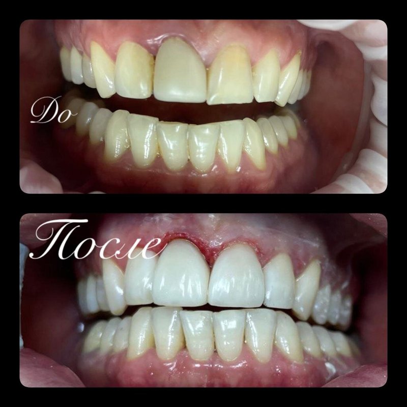 фотография работы Стоматологической клиники New Smile