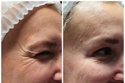 Косметология Prime Esthetic, с рейтингом 3.3 - находится по адресу Санкт-Петербург, Капитанская улица, 4 