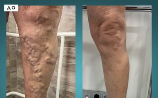 фотография работы врача Илья Николаевича Сороквашы