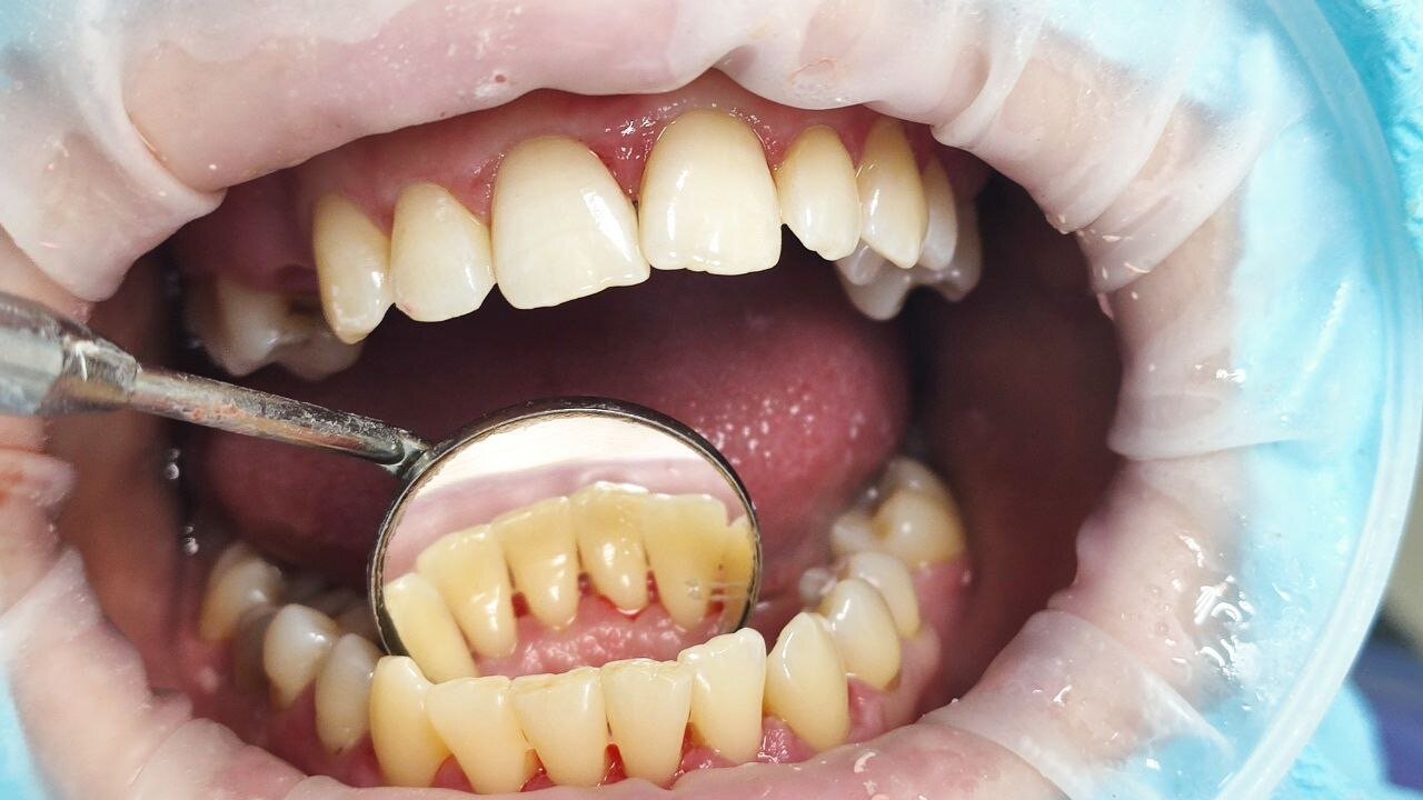 фотография работы Стоматологии ANIDENT в Балашихе