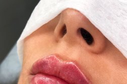 Косметология Milano Clinic, с рейтингом 4.5 - находится по адресу Москва, Бауманская улица, 13с3 