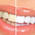 фотография New dent