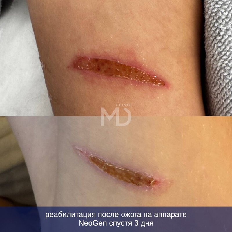 фотография работы Клиники аппаратной и эстетической косметологии MD Клиника на улице Зорге