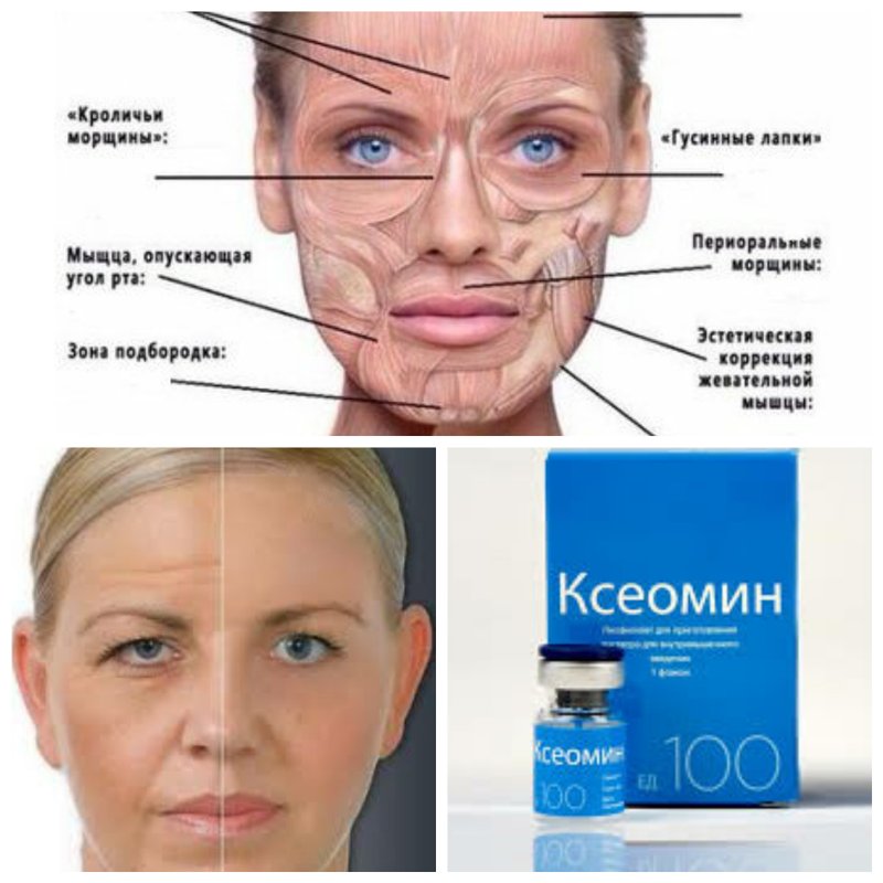 Ботокс лица до и после можно Цены косметического кабинета на улице имени 40-летия Победы в Краснодаре - Zoon