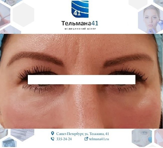 фотография работы Медицинского центра Тельмана 41 (Центр имплантологии доктора Зорина)