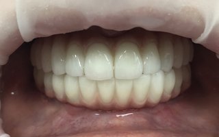 фотография работы врача Шавката Джуратовича Батырова
