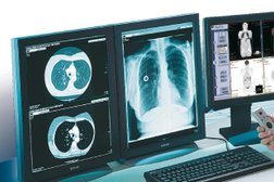 Московский центр МРТ, с рейтингом 4.6 - находится по адресу Москва, Неверовского улица, 10 