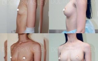 фотография работы врача Дмитрия Олеговича Васильева