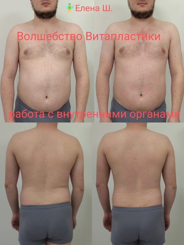фотография работы Минус пять - Волшебство Витапластики