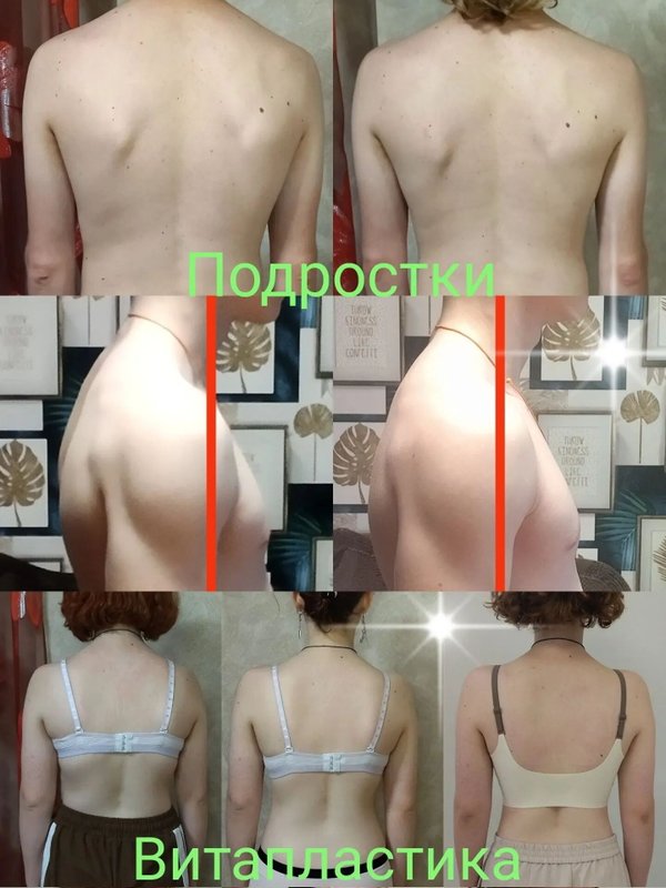 фотография работы Минус пять - Волшебство Витапластики