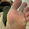фото от пользователя Ирина  в отзыве о центре подологии Podo_clinik_msk