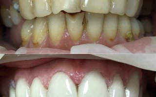 фотография работы врача Сергея Геннадьевича Локтионова
