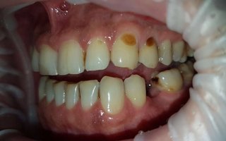 фотография работы врача Лауры Григорьевны Мнацаканян