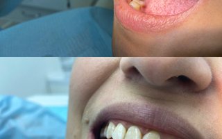 фотография работы врача Серине Альбертовны Аршакян