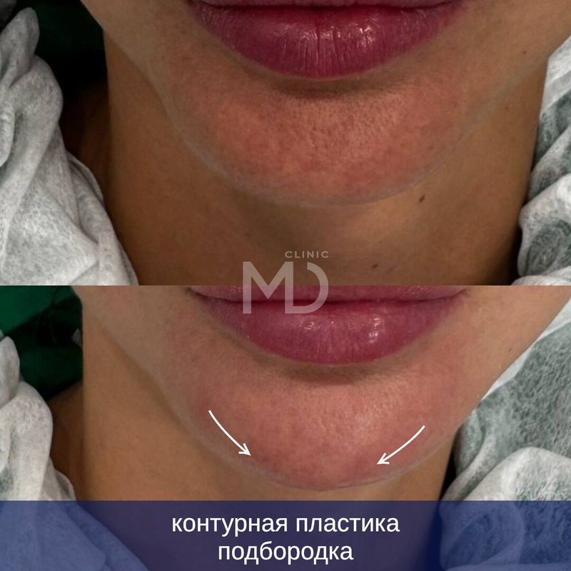 фотография работы Клиники аппаратной и эстетической косметологии MD Клиника на улице Зорге