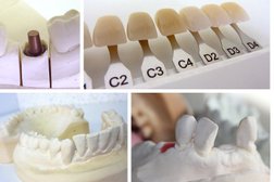 Стоматологическая клиника Premium Dental, с рейтингом 3.2 - находится по адресу Алматы, Назарбаева проспект, 165 