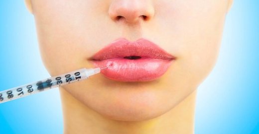 Почему контурная пластика губ пользуется широкой популярностью?