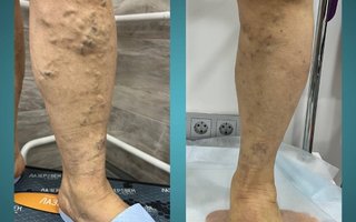 фотография работы врача Илья Николаевича Сороквашы