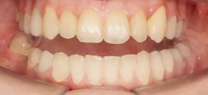 фотография работы Стоматологической клиники DENTBLANC на Мичуринском проспекте