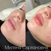 фото от пользователя Елена Золотарева в отзыве о клинике косметологии Beautyline