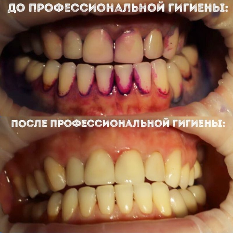 фотография работы Стоматологической клиники Айсберг+ на улице Доблести