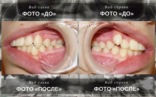 фотография работы врача Виктории Сергеевны Сироткиной