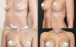 фотография работы врача Дмитрия Олеговича Васильева