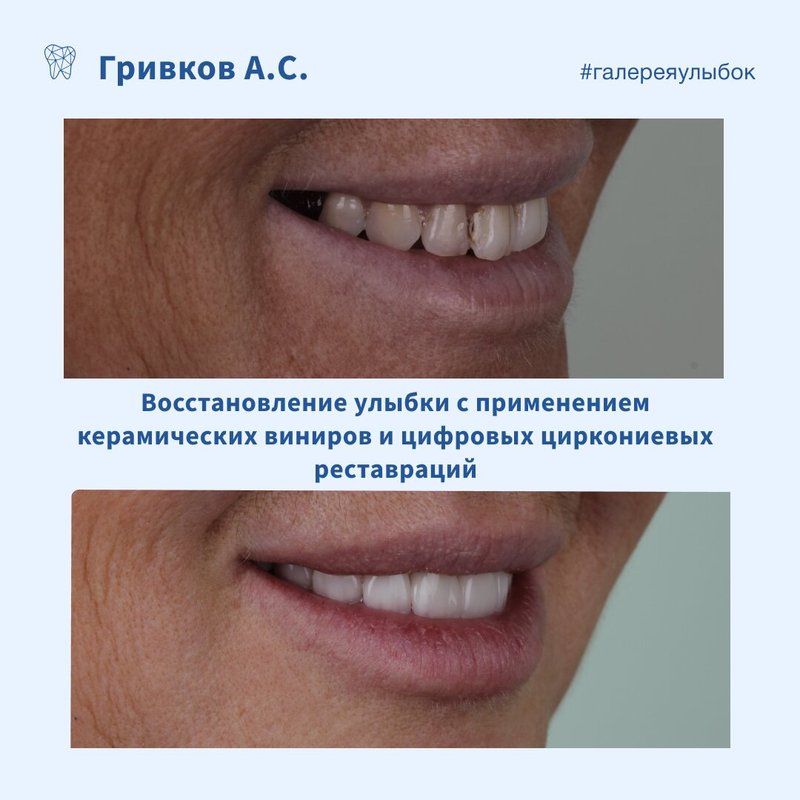фотография работы Цифровой стоматологии ДоДоктор в Луговом