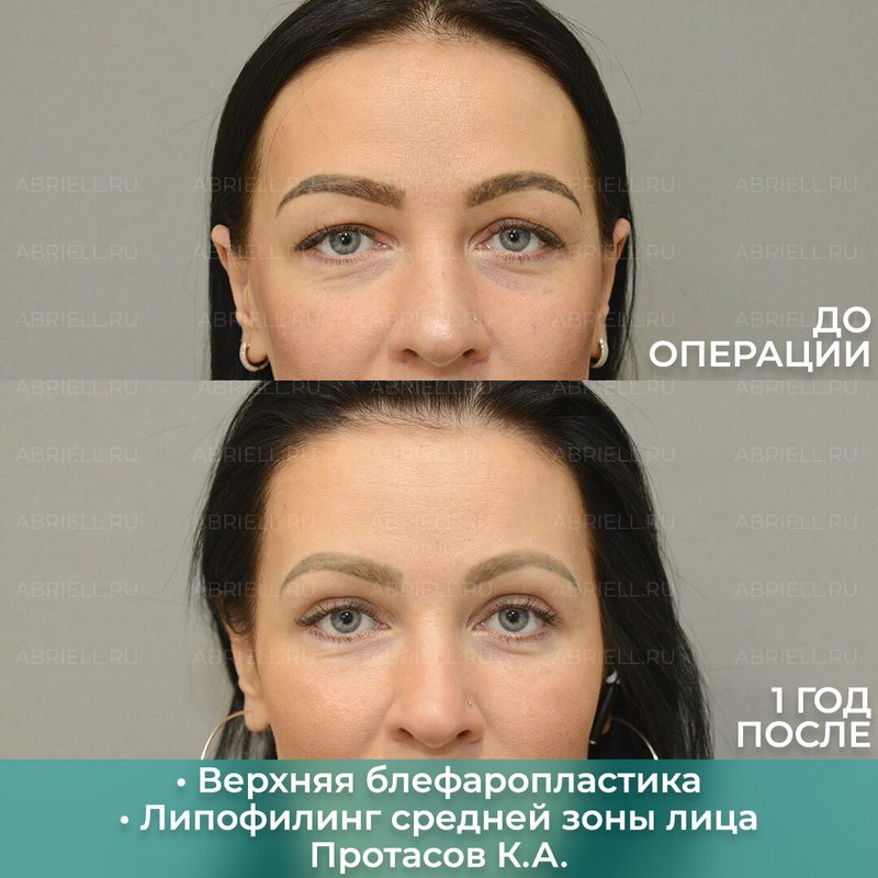 фотография работы Клиники пластической хирургии и косметологии Абриелль в Василеостровском районе