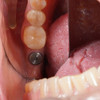фото от пользователя Полина в отзыве о стоматологической клинике ОртоЛайк на бульваре Энтузиастов