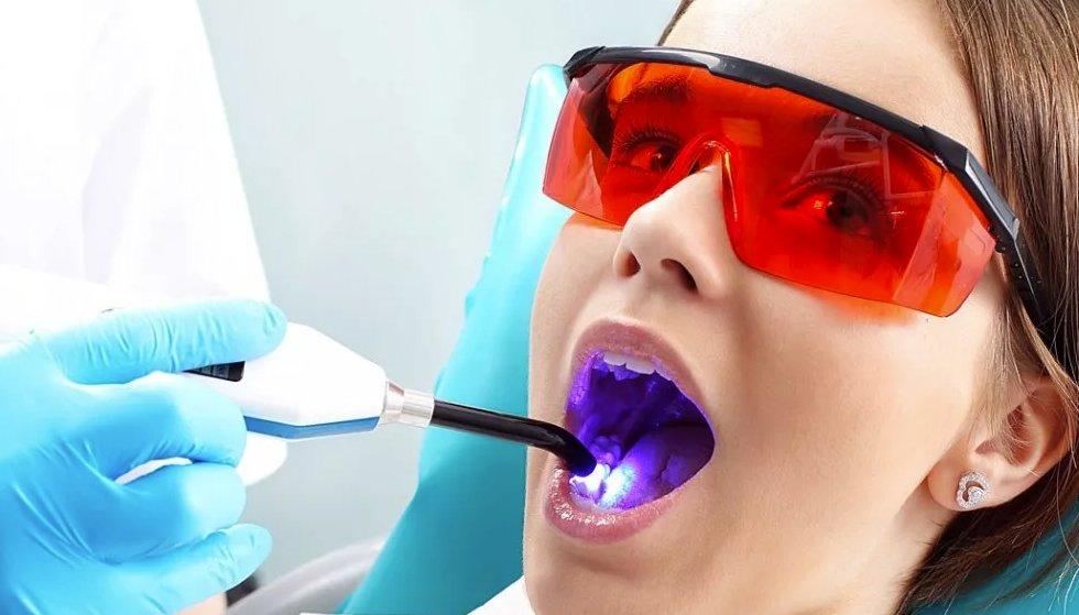 Лазерное десен. Аргоновый лазер в стоматологии. Лазерное отбеливание зубов. Лазерное излучение в стоматологии.