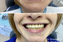 Стоматологическая клиника Эстетика плюс, с рейтингом 4.8 - находится по адресу Республика Адыгея, Майкоп, улица 12 Марта, 142 