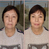 фото от пользователя Карина в отзыве о клинике эстетической медицины Вирсавия