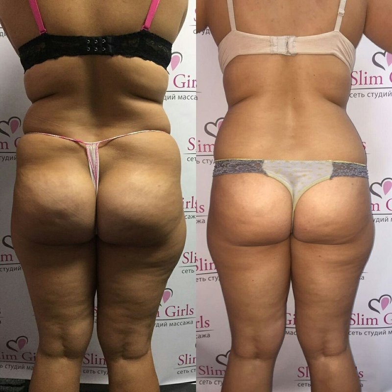 Процедуры Санаторий Орджоникидзе