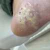 фото от пользователя Ирина  в отзыве о центре подологии Podo_clinik_msk