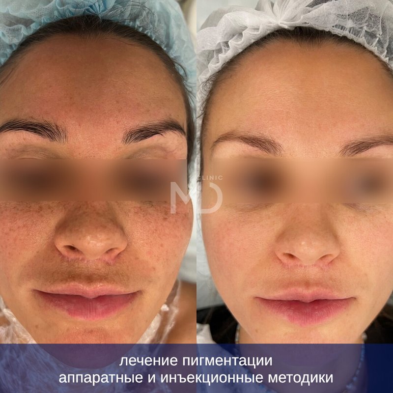 фотография работы Клиники аппаратной и эстетической косметологии MD Клиника на улице Зорге