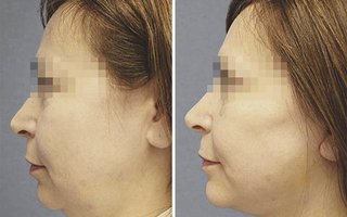 фотография работы врача Марины Анатольевны Четвериковой
