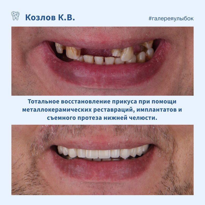 фотография работы Цифровой стоматологии ДоДоктор в Луговом