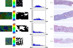 Многопрофильный лечебно-диагностический реабилитационный центр Эссен клиник, с рейтингом 2 - находится по адресу Ставропольский край, Ессентуки, Советская улица, 20Б 