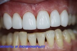 Стоматологическая клиника Универсал, с рейтингом 3.4 - находится по адресу Алматы, Абая проспект, 69 