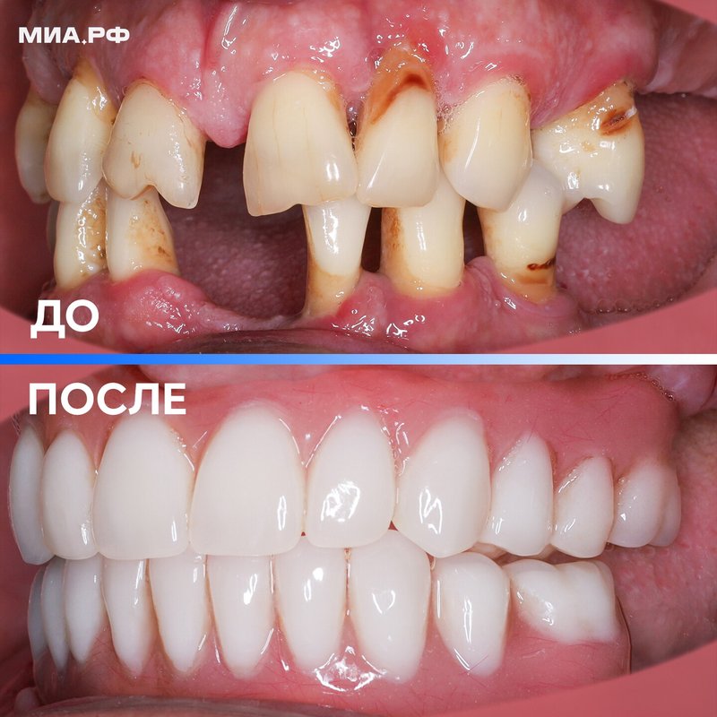 фотография работы Центра имплантации и стоматологии МИА.РФ на метро Рижская