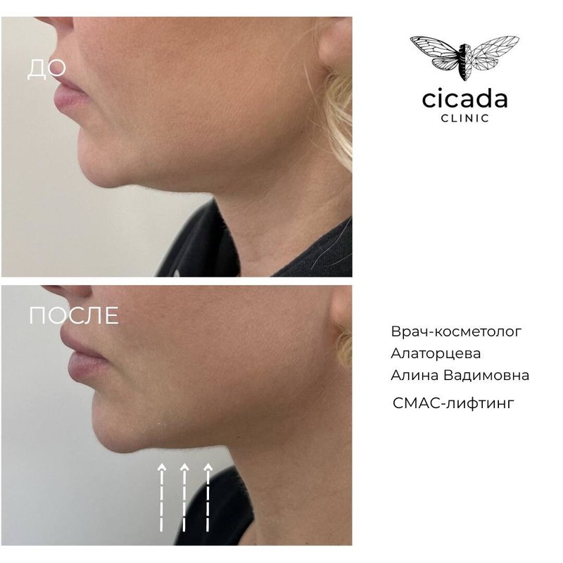 фотография работы Клиники инновационной косметологии Cicada Clinic
